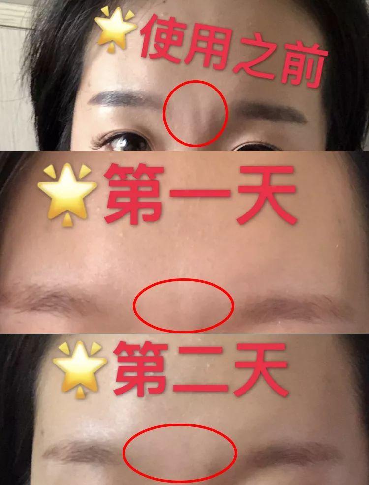 眉心皺紋_眉心皺紋川是什麽原因_皺紋眉心有一條豎紋女人好不好