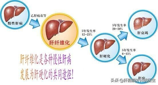 掌紋與健康_掌紋健康線反應的疾病_掌紋健康線發紅