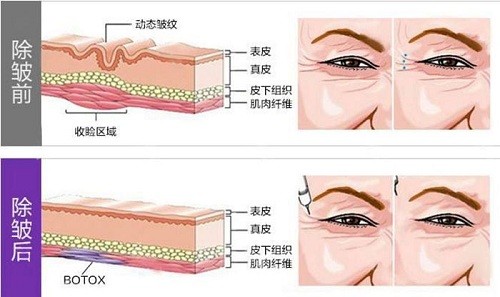 額頭上有豎紋_額頭左邊有一道豎紋_額頭兩側有明顯的豎紋