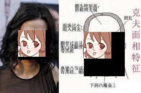 女人顴骨高克夫嗎 顴骨高的女人克夫相