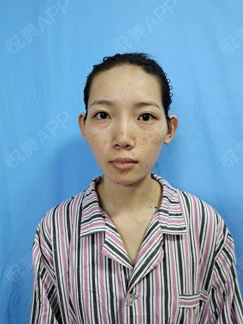 女人顴骨高真的克夫嗎_女人顴骨高真的克夫嗎?_顴骨高克夫