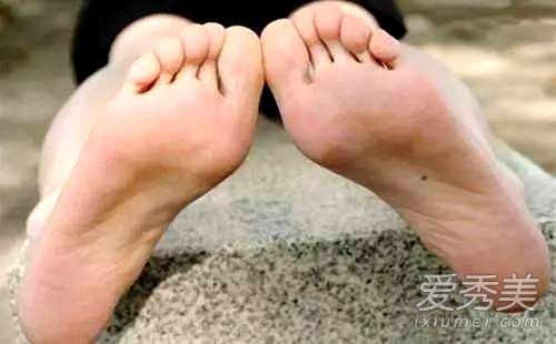 女人腳底有痣好不好 女人腳底有痣代表什麼