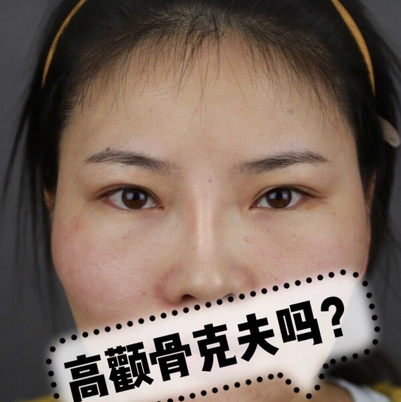 顴骨高女人圖片_顴骨高的女人_女人額頭窄顴骨高