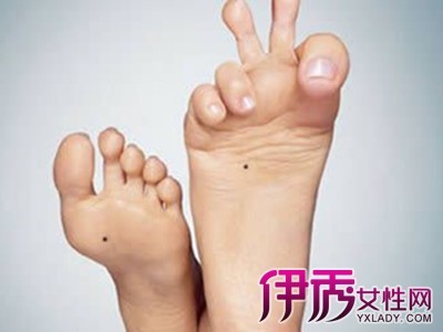 腳底有痣的女人好不好_腳底和手掌有痣好不好_腳底有痣好嗎