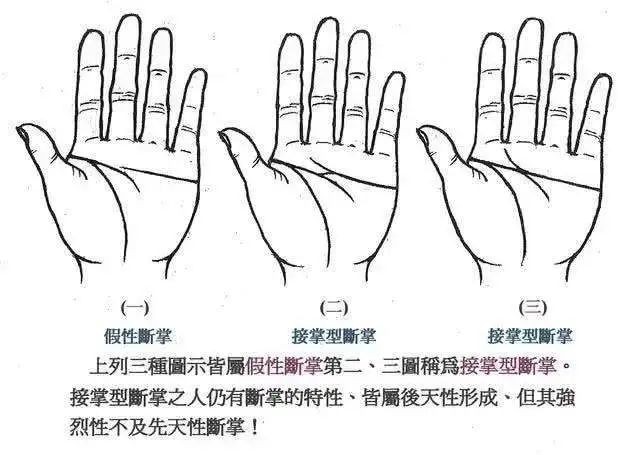 雙手斷掌紋_女人斷掌紋_斷手紋和斷掌紋一樣嗎