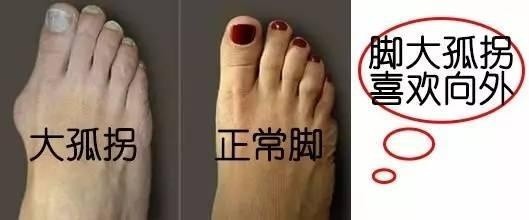 看過了手相，面向，你們是否看過腳相呢，腳相知命運